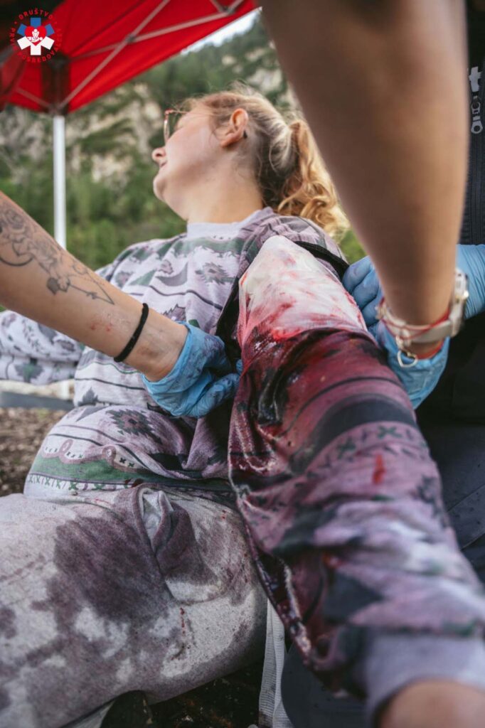 Poskodba pirotehnika ppo